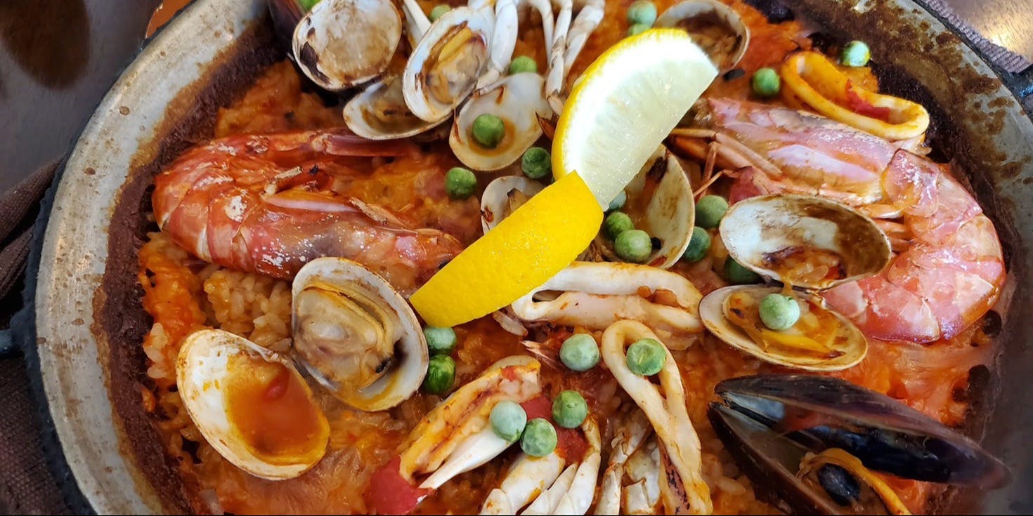 シャント - 画像5